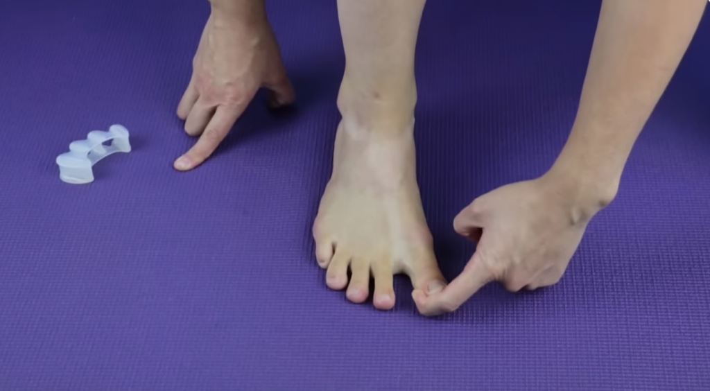 Straightening the big toe as part of bunion exercise