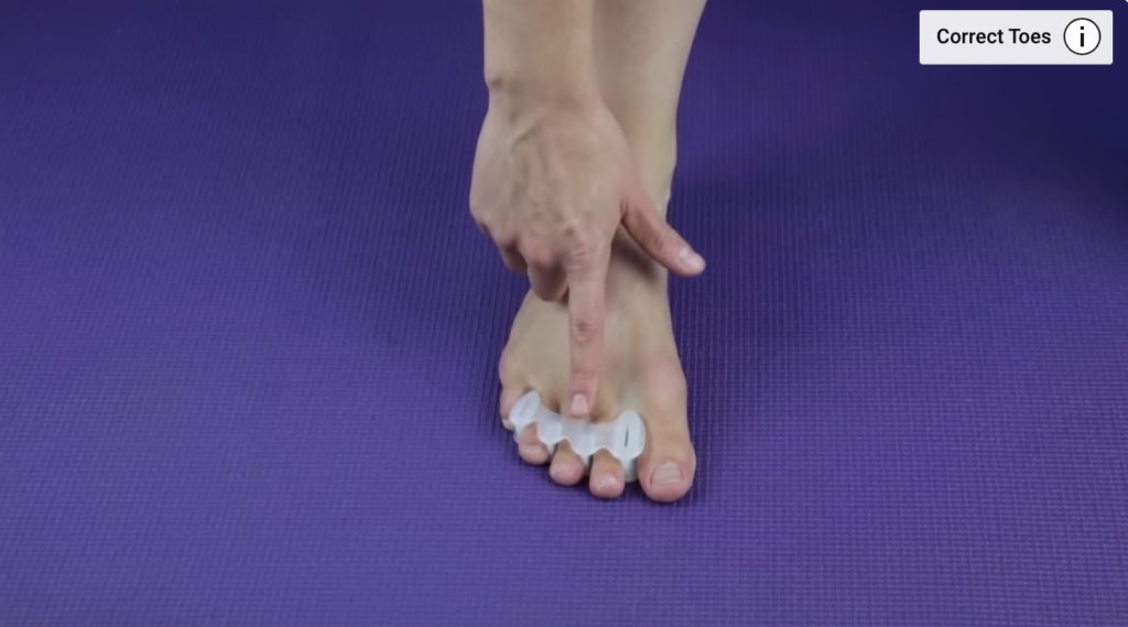 Using Correct Toes for bunion exercise